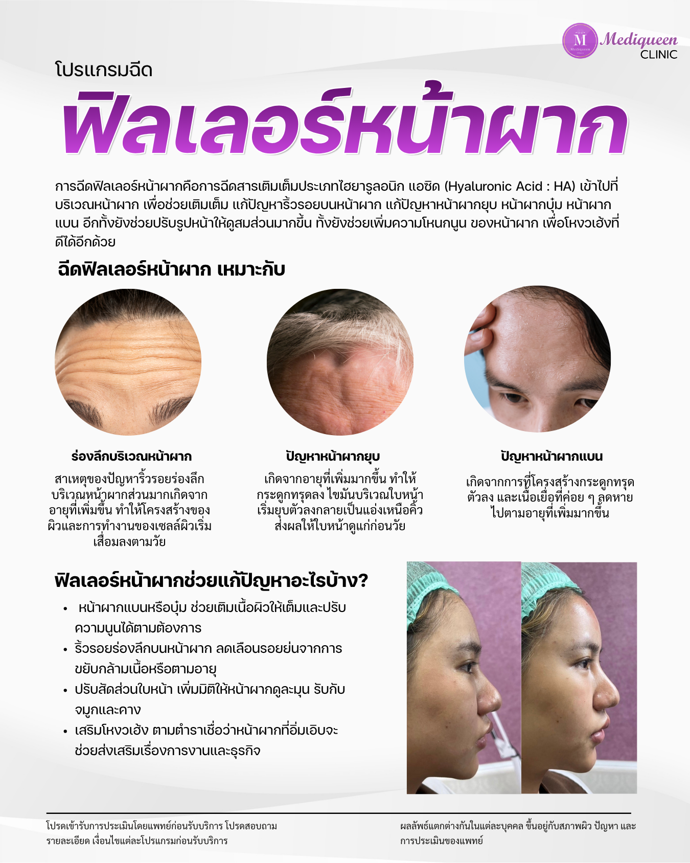 หน้าสไลด์ Flipbook ของเมดิควีนส์ คลินิก